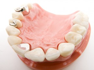 tooth_img002
